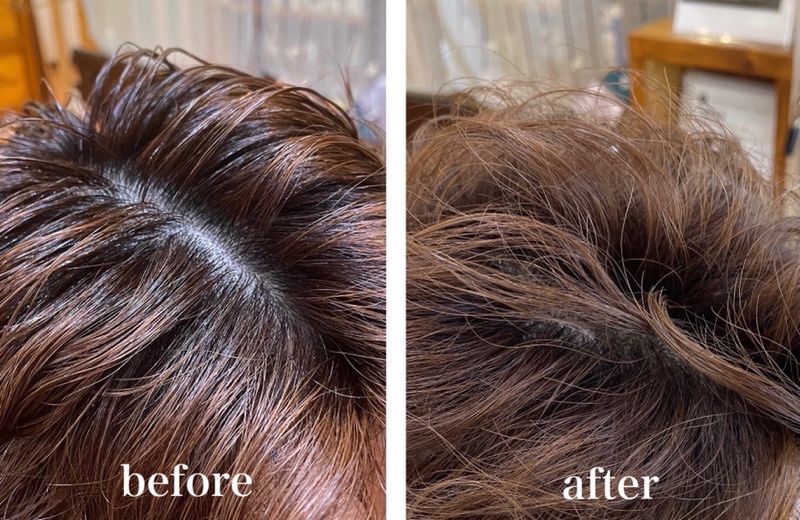 フケ かゆみ は頭皮の乾燥が原因 症状を改善できるスキャルプシャンプー トリートメントがデビュー 髪質改善 福岡県 Hair Mahalo